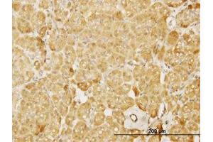 Image no. 2 for anti-Neural Wiskott-Aldrich syndrome protein (WASL) (AA 97-185) antibody (ABIN598590) (Neural Wiskott-Aldrich syndrome protein (WASL) (AA 97-185) 抗体)