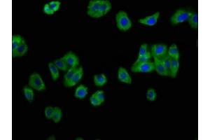 Immunofluorescence staining of HepG2 cells with ABIN7156777 at 1:133, counter-stained with DAPI. (IL12RB2 抗体  (AA 366-470))