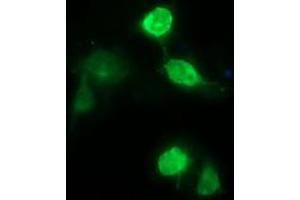 Image no. 3 for anti-CD163 (CD163) antibody (ABIN1497170) (CD163 抗体)