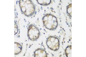Immunohistochemistry of paraffin-embedded human colon using ACCS antibody (ABIN6293455) at dilution of 1:200 (40x lens).