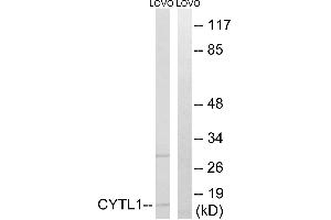 Immunohistochemistry analysis of paraffin-embedded human brain tissue using CYTL1 antibody. (CYTL1 抗体)