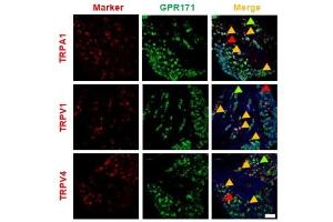 Double immunostaining of GPR171 expressions in Transient receptor potential (TRP)-expresser neurons and the effect on TRP-mediated nociceptions of GPR171 activation.