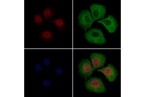 hFANCI Antibody staining Hela cells by IF/ICC. (FANCI 抗体  (C-Term))