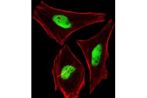 Immunofluorescent analysis of 4 % paraformaldehyde-fixed, 0. (PHF6 抗体  (AA 315-349))