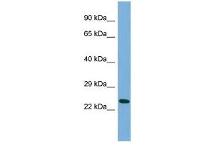 Host:  Rabbit  Target Name:  MANEAL  Sample Type:  HepG2 Whole cell lysates  Antibody Dilution:  1. (MANEAL 抗体  (Middle Region))