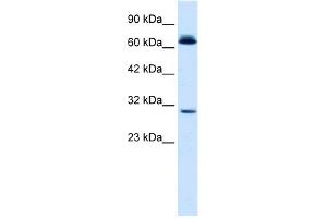 WB Suggested Anti-SIRT3 Antibody Titration:  0. (SIRT3 抗体  (C-Term))