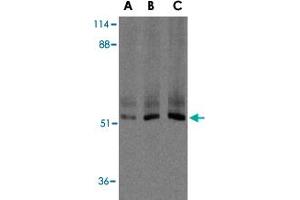 Western blot analysis of XIAP in human kidney lysate with XIAP polyclonal antibody  at 0. (XIAP 抗体  (C-Term))