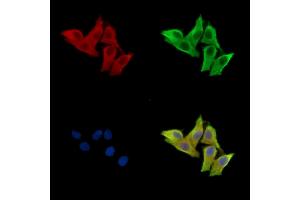 ABIN7096590 and ABIN7100654 staining HepG2 cells by IF/ICC. (MARCO 抗体)