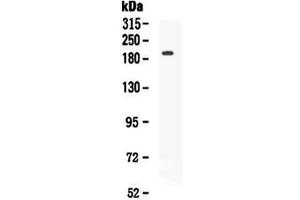 Western blot analysis of VEGF Receptor 2 using anti-VEGF Receptor 2 antibody . (VEGFR2/CD309 抗体  (AA 20-244))