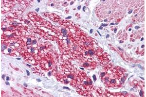 Human Colon, Nerve: Formalin-Fixed, Paraffin-Embedded (FFPE) (SIP1 抗体  (C-Term))