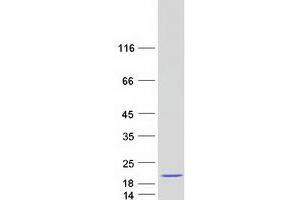 Western Blotting (WB) image for Calcium Binding Protein 5 (CABP5) protein (Myc-DYKDDDDK Tag) (ABIN2713004)