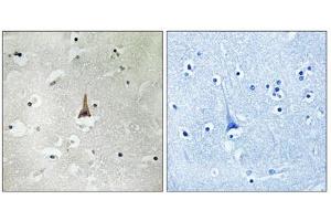 Immunohistochemistry analysis of paraffin-embedded human brain tissue using LRP10 antibody. (LRP10 抗体  (Internal Region))