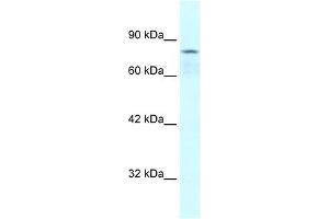 Human Jurkat; WB Suggested Anti-COLEC12 Antibody Titration: 0. (COLEC12 抗体  (Middle Region))