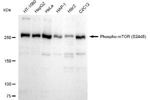 Western blotting analysis using Phospho-mTOR (S(ABIN7800001) antibody (ABIN7799348). (Recombinant MTOR 抗体  (pSer2448))