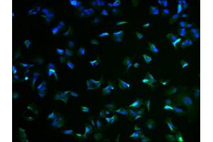 Immunofluorescence staining of MCF-7 cells with ABIN7167574 at 1:100, counter-stained with DAPI. (RIMS4 抗体  (AA 1-269))