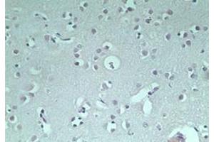 Image no. 1 for anti-Ring Finger Protein 128 (RNF128) (AA 227-253) antibody (ABIN207733) (RNF128 抗体  (AA 227-253))