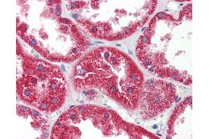 Immunohistochemistry (IHC) image for anti-Histidine Triad Nucleotide Binding Protein 1 (HINT1) (N-Term) antibody (ABIN2785874) (HINT1 抗体  (N-Term))