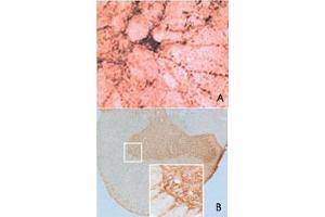 Immunohistochemical staining of SNCB in rat spinal cord using SNCB polyclonal antibody  at a dilution of 1 : 1000. (beta Synuclein 抗体  (AA 108-125))