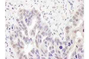 Immunohistochemistry (IHC) image for anti-Polymerase (DNA Directed), delta 2, Accessory Subunit (POLD2) (AA 419-469) antibody (ABIN7455022)