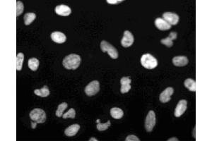 Immunofluorescent staining of U-2 OS (ATCC HTB-96) cells. (PARP1 抗体)