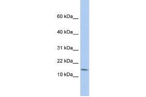 WB Suggested Anti-BTG2 Antibody Titration:  0. (BTG2 抗体  (N-Term))