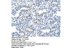 Rabbit Anti-PAIP1 Antibody  Paraffin Embedded Tissue: Human Lung Cellular Data: Alveolar cells Antibody Concentration: 4. (PAIP1 抗体  (C-Term))