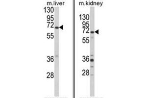 (LEFT) Western blot analysis of EHHADH Antibody (C-term) in mouse liver tissue lysates (35ug/lane). (EHHADH 抗体  (C-Term))