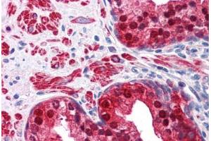 Human Prostate: Formalin-Fixed, Paraffin-Embedded (FFPE) (IDH1 抗体  (AA 30-307))