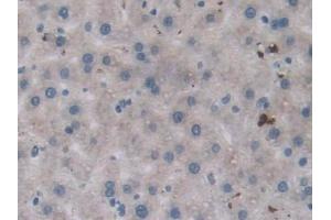 Immunohistochemistry (IHC) image for anti-Protein tyrosine Phosphatase, Receptor Type, B (PTPRB) (AA 1041-1310) antibody (ABIN7443743)