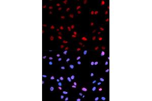 Immunofluorescence analysis of U2OS cell using Phospho-RB-S795 antibody. (Retinoblastoma 1 抗体  (pSer795))