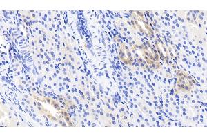 Detection of CRYl1 in Human Kidney Tissue using Monoclonal Antibody to Crystallin Lambda 1 (CRYl1) (CRYL1 抗体  (AA 24-232))