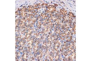 Immunohistochemistry of paraffin-embedded rat stomach using CTNN Rabbit mAb (ABIN7266135) at dilution of 1:100 (40x lens). (CTNNA3 抗体)