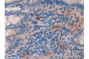 Detection of LCNL1 in Rat Small intestine Tissue using Polyclonal Antibody to Lipocalin Like Protein 1 (LCNL1) (LCNL1 抗体)