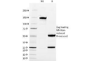 SDS-PAGE Analysis Purified CD13 Mouse Monoclonal Antibody (WM15). (CD13 抗体)
