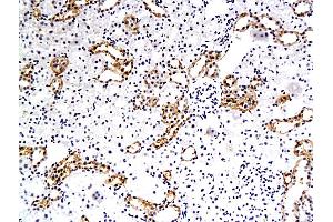 Immunohistochemistry (IHC) image for anti-Solute Carrier Family 1 (Neuronal/epithelial High Affinity Glutamate Transporter, System Xag), Member 1 (SLC1A1) (AA 451-524) antibody (ABIN733943)