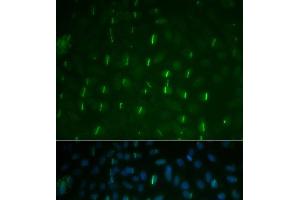 Immunofluorescence analysis of U2OS cells using Phospho-γH2A. (gamma H2AX 抗体  (pSer139))
