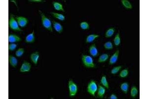 Immunofluorescent analysis of A549 cells using ABIN7175150 at dilution of 1:100 and Alexa Fluor 488-congugated AffiniPure Goat Anti-Rabbit IgG(H+L) (USHBP1 抗体  (AA 1-260))