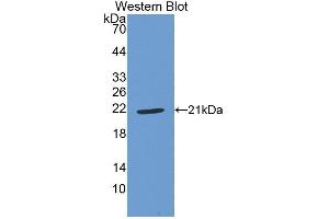 Detection of Recombinant GPX1, Human using Polyclonal Antibody to Glutathione Peroxidase 1 (GPX1) (Glutathione Peroxidase 1 抗体  (AA 50-203))