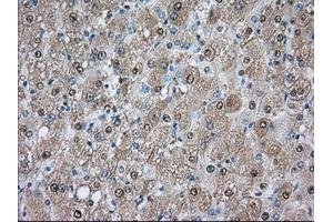 Immunohistochemical staining of paraffin-embedded prostate tissue using anti-PDE4A mouse monoclonal antibody. (PDE4A 抗体)