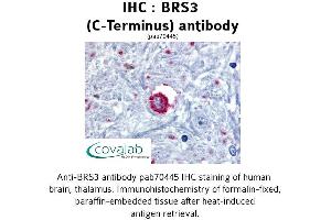 Image no. 1 for anti-Bombesin-Like Receptor 3 (BRS3) (C-Term), (Cytoplasmic Domain) antibody (ABIN1732418) (BRS3 抗体  (C-Term, Cytoplasmic Domain))