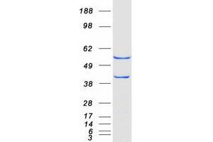 Western Blotting (WB) image for Adenylyl Cyclase Associated Protein 2 (CAP2) protein (Myc-DYKDDDDK Tag) (ABIN2713110)