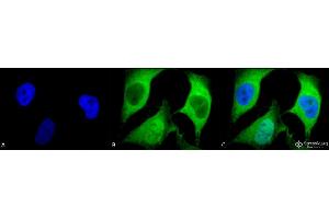 Immunocytochemistry/Immunofluorescence analysis using Mouse Anti-Ubiquitin Monoclonal Antibody, Clone 5B9-B3 . (Ubiquitin 抗体  (Atto 390))