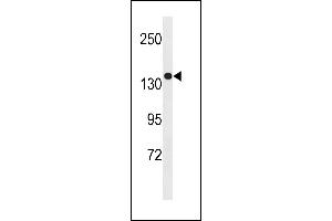 SGSM1 Antibody (Center) (ABIN1881801 and ABIN2843255) western blot analysis in MDA-M cell line lysates (35 μg/lane). (SGSM1 抗体  (AA 624-652))