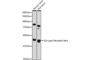 Western blot analysis of extracts of various cell lines, using Estrogen Receptor beta antibody (ABIN3016231, ABIN3016232, ABIN3016233 and ABIN6219642) at 1:1000 dilution. (ESR2 抗体  (AA 1-280))
