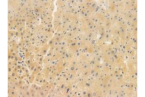 ABIN6265555 and ABIN6266853 at 1/100 staining human normal liver tissue by IHC-P. (Transglutaminase 2 抗体  (N-Term))