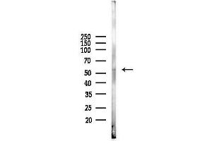 anti-Sec61 alpha 1 Subunit (SEC61A1) (C-Term) antibody