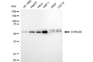 Western blotting analysis using CHRNA5 antibody (ABIN7798056).