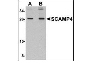 Western blot analysis of SCAMP4 in 3T3 cell lysate with this product at (A) 1 and (B) 2 μg/ml. (SCAMP4 抗体  (C-Term))