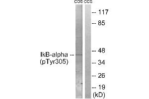 Immunohistochemistry analysis of paraffin-embedded human lymph node tissue using IκB-α (Phospho-Tyr305) antibody. (NFKBIA 抗体  (pTyr305))