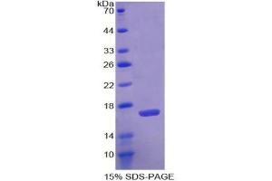 SDS-PAGE analysis of Human Agmatine Ureohydrolase Protein.